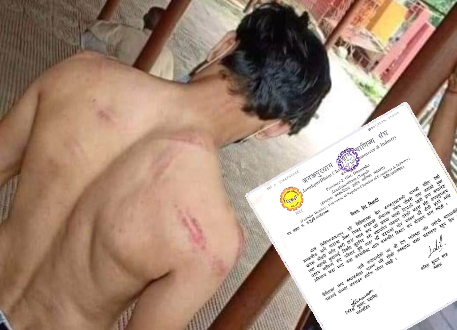 लकडाउनमा पसल खोलेको भन्दै प्रहरीबाट कुटपिट